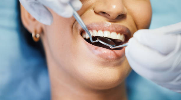 Best Broken or Chipped Tooth Repair in Sonterra, TX